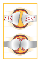 Hk Strickland, medical illustration arthritis, bath