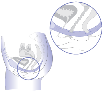 Hk Strickland, medical illustration, women's health
