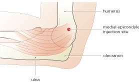 Hilary Strickland - Design, Illustration, Medical Illustration, Bath
