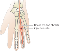 Hilary Strickland - Design, Illustration, Medical Illustration, Bath